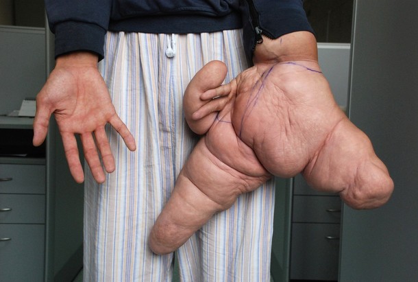 <?php the_title(); ?>