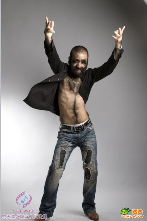 Самый волосатый человек